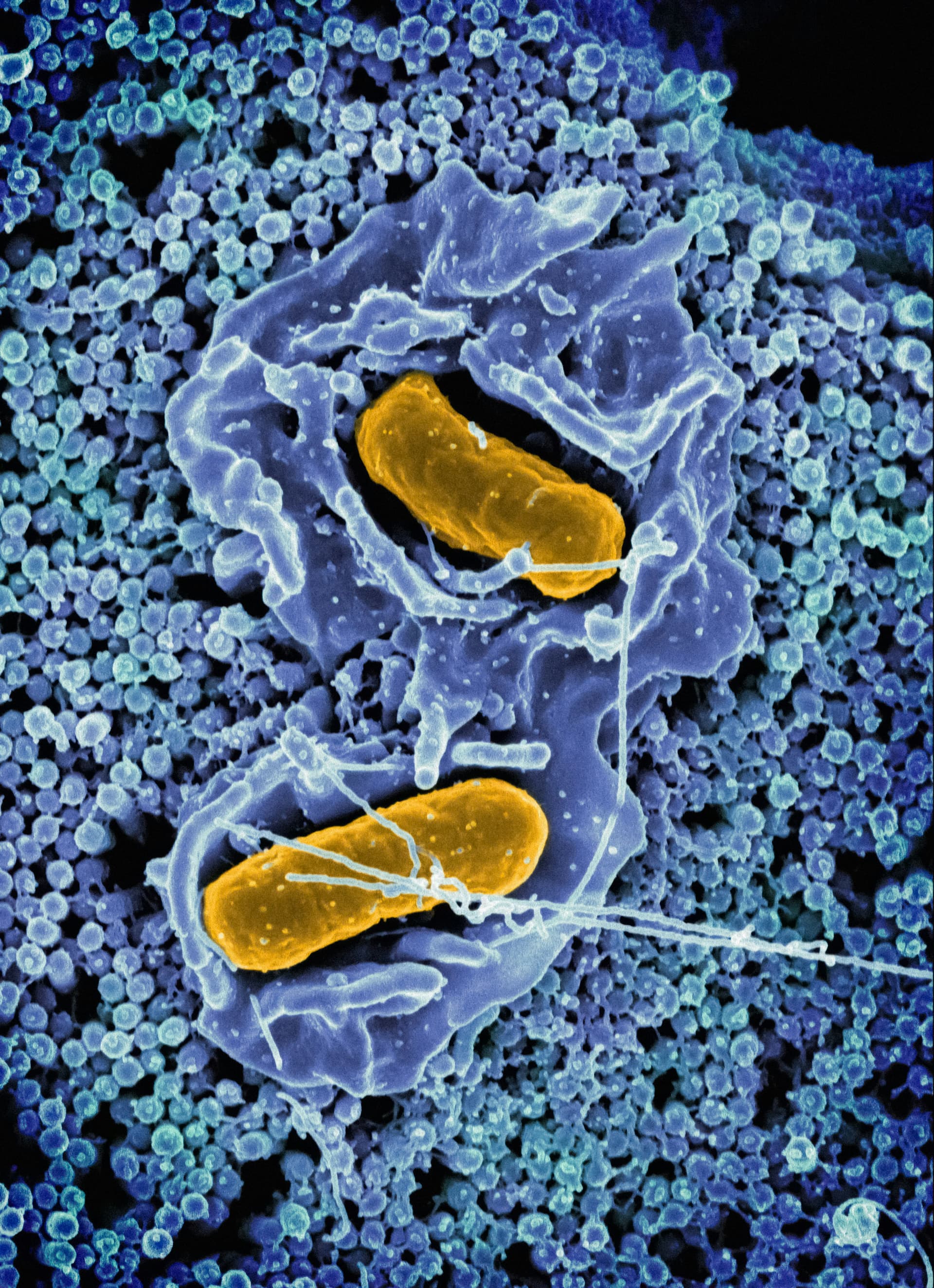 Microbioma orale e salute generale detail 1