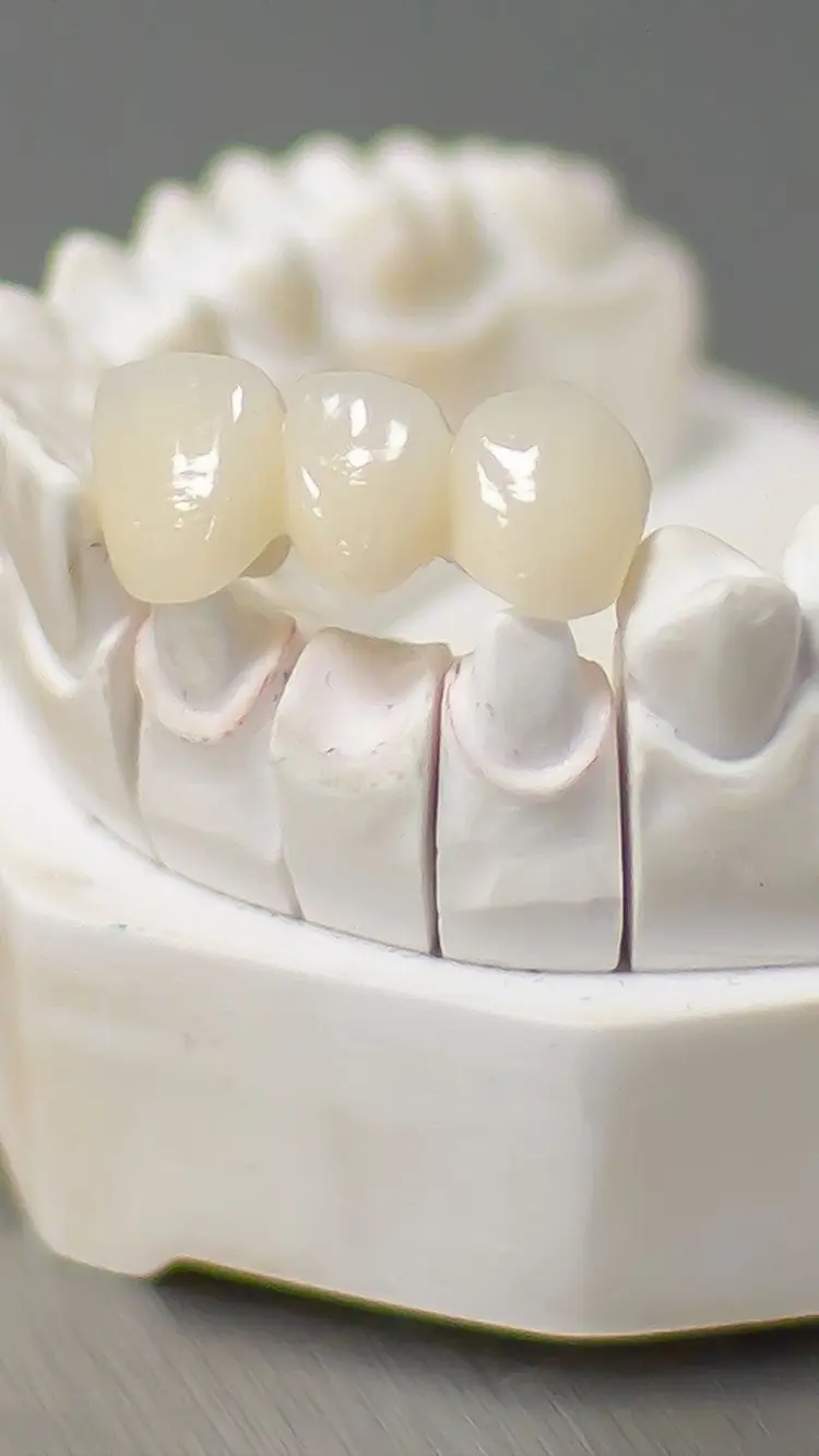 Crowns