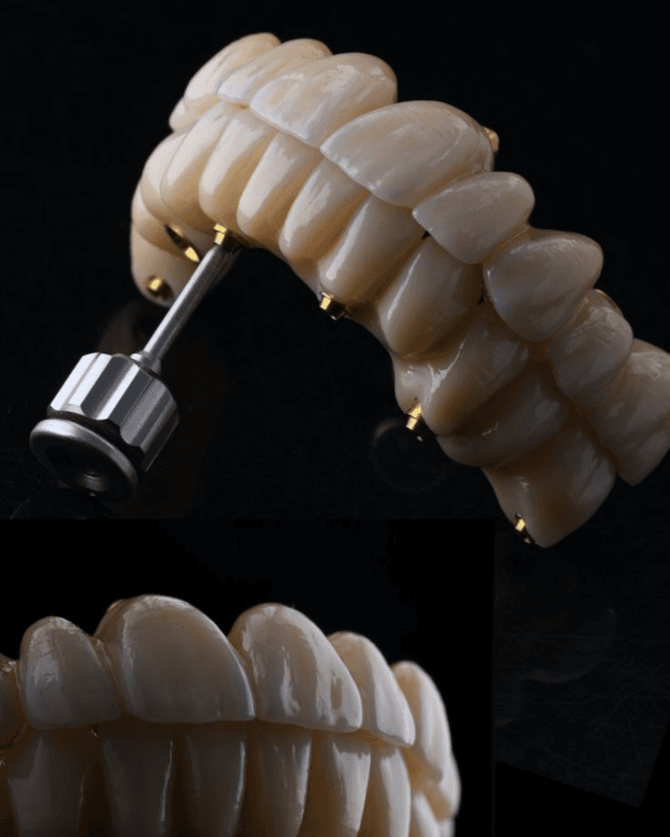Implantology