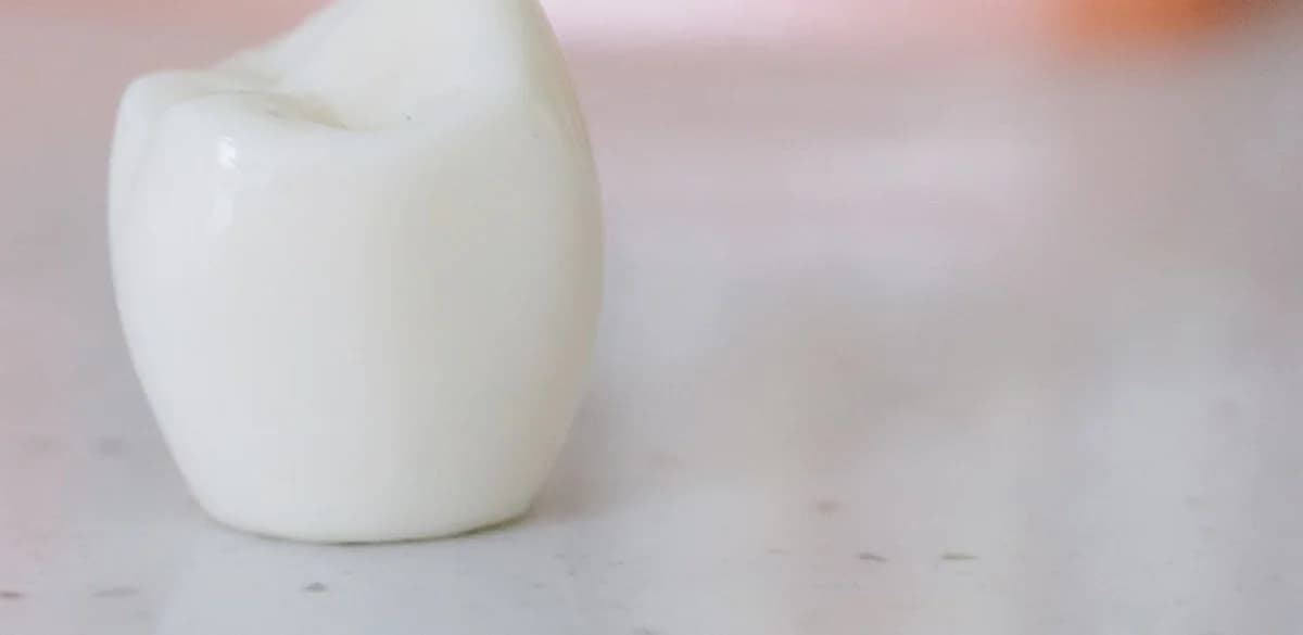 Close-up of a ceramic dental crown