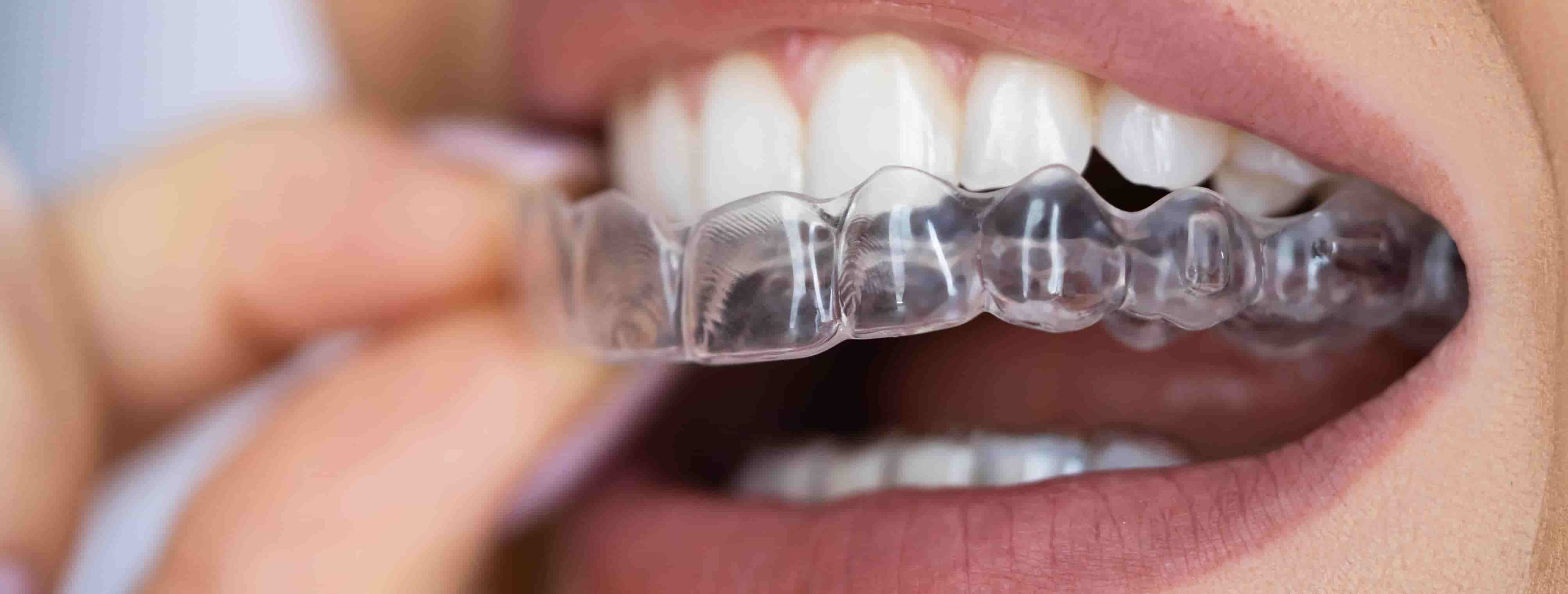 Orthodontics